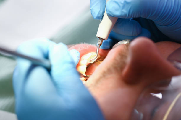 Best Dentist for Severe Toothache  in Maysville, OK