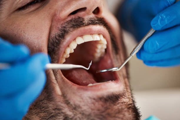 Best Tooth Infection Emergency Dentist  in Maysville, OK