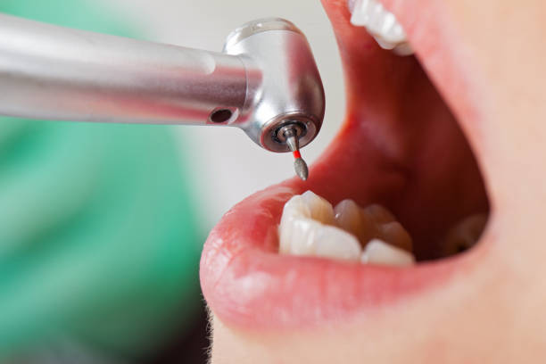Best Dentist for Tooth Abscess  in Maysville, OK